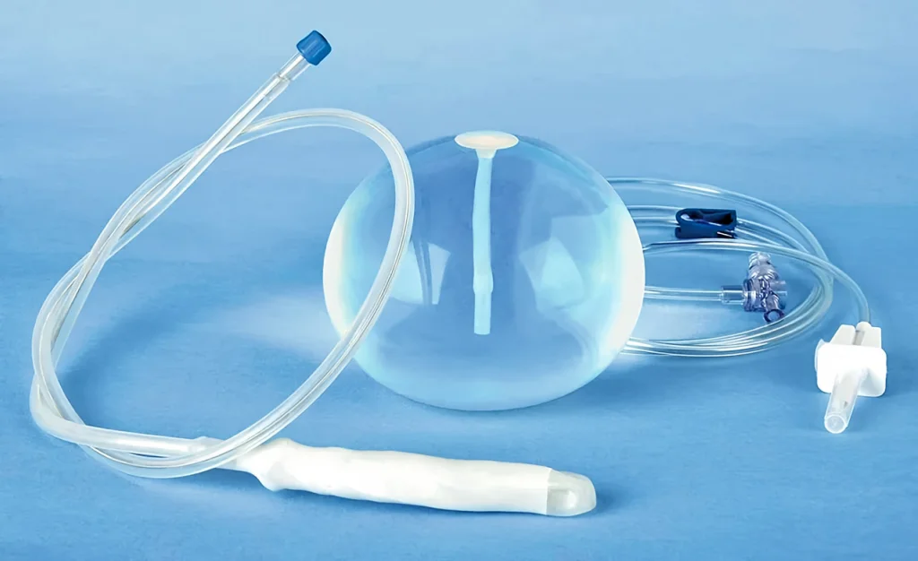 Снижение веса без операции доступно в Эндохирургическом Центре в Калуге